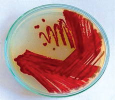 https://www.biotechnologia-journal.org/f/fulltexts/215700/BTA-107-1-215700-g001_min.jpg