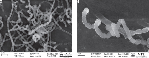 https://www.biotechnologia-journal.org/f/fulltexts/215700/BTA-107-1-215700-g002_min.jpg