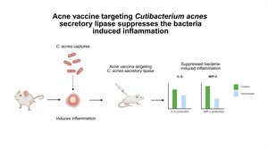 Figure from article: Acne vaccine targeting...