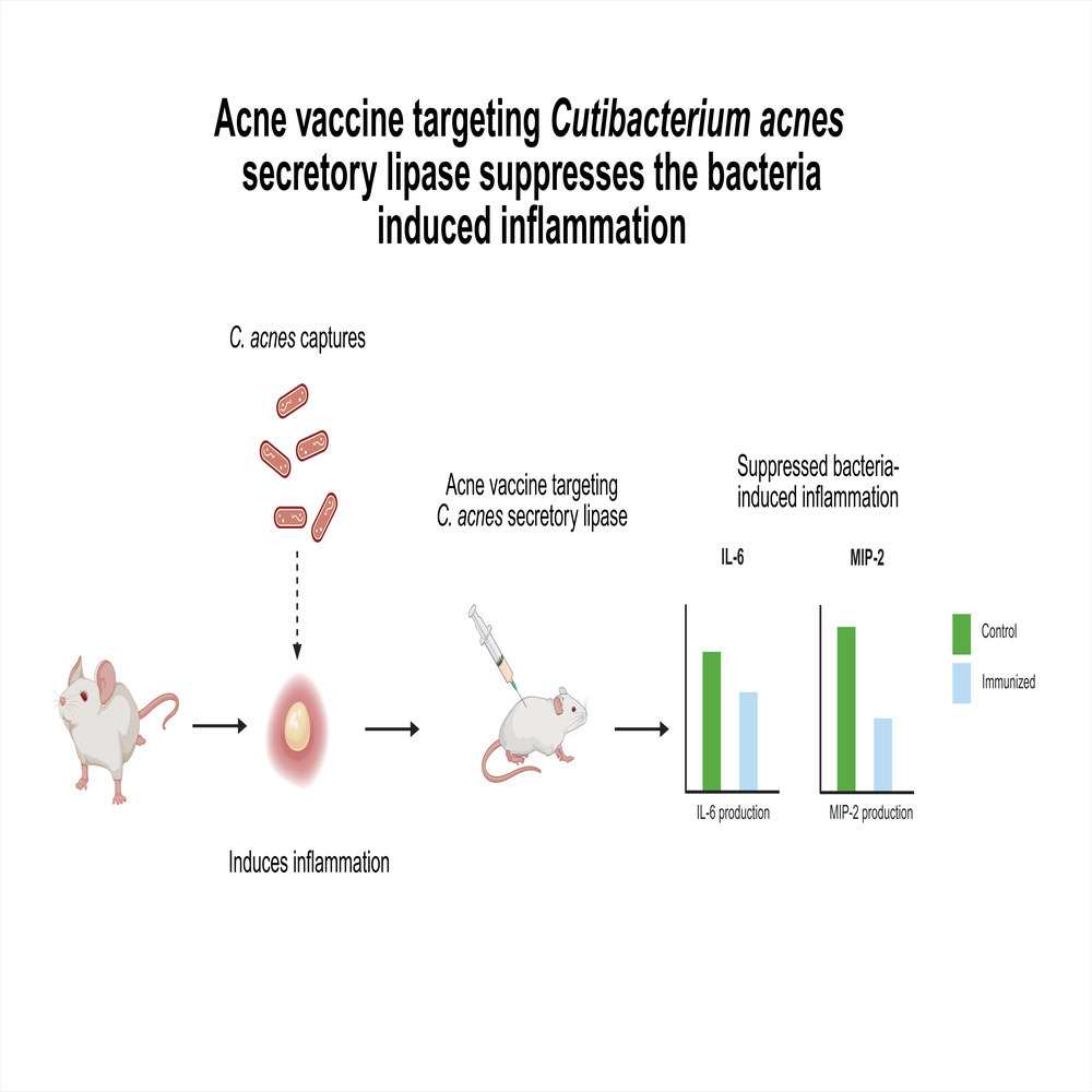 Figure from article: Acne vaccine targeting...